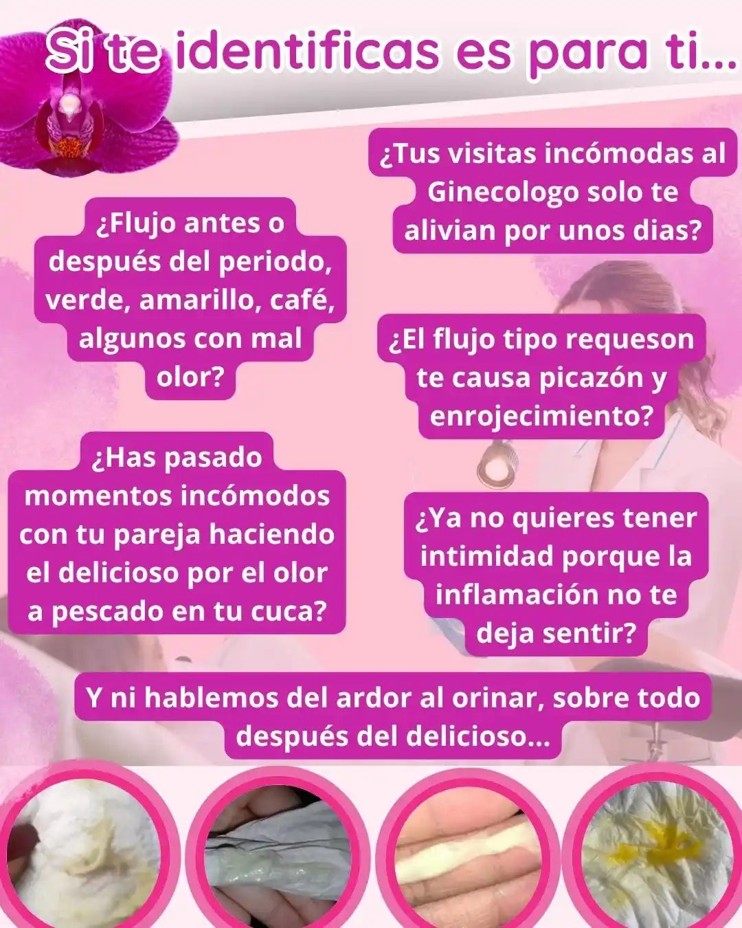 FEM POR